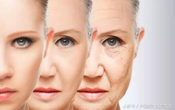 超声刀可以除皱吗,超声刀后脸部肿胀怎么办