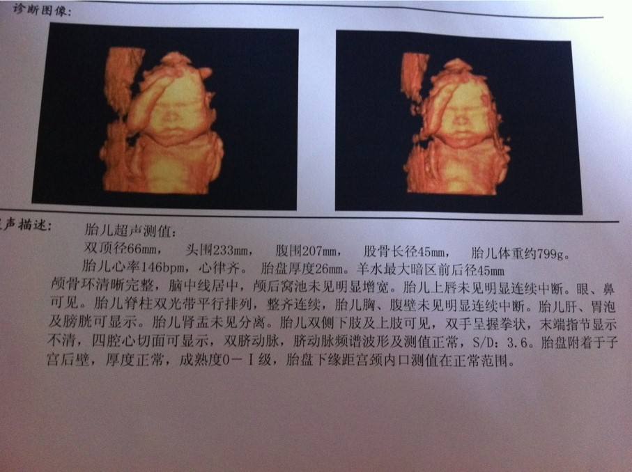 刚怀孕20天的抽血检查报告单,孕妈必须要看懂的孕检报告