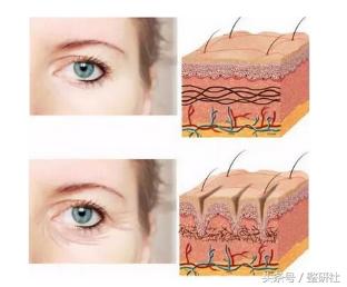 医美联合治疗拒绝“阿婆”面相