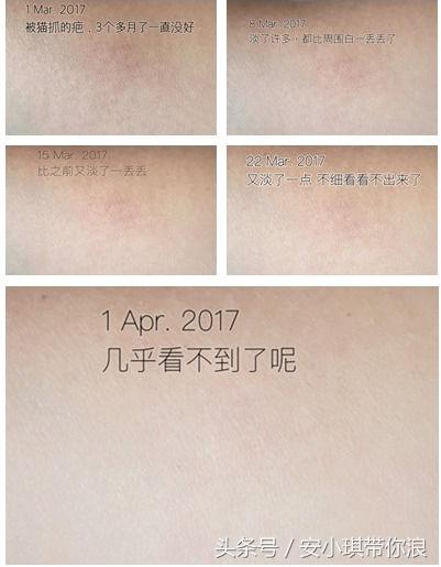 一白遮百丑美白攻略,一白遮三丑星星版美白