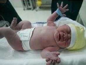 剖腹产修复盆底肌,剖腹产多久可以修复盆底肌