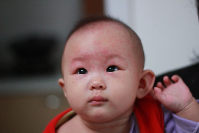 宝宝发烧反反复复一般是什么原因,宝宝反反复复发烧好担心怎么办