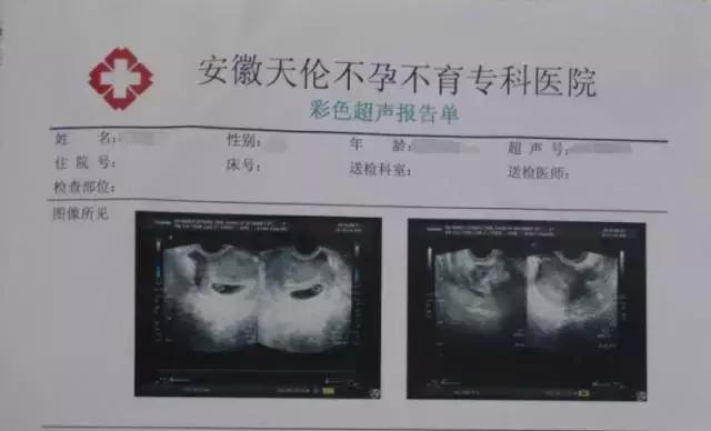 人流+药流，你须谨慎对待！