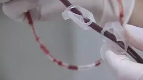 脐带血捐好还是自存好,血液科医生建议存脐带血有必要吗