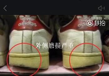 小腿不直什么动作矫正不外翻,矫正腿型小腿外翻的动作