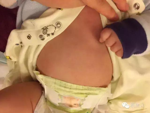 新生儿宝宝红疹子怎么引起的,新生儿皮肤起红疹子怎么办