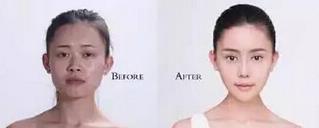 重庆女孩自曝整容日记，迷教主花百万变形为Angelababy