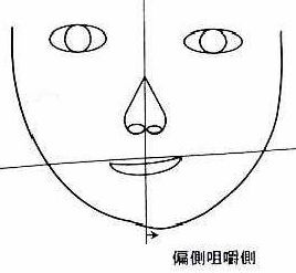 你的脸为什么会一边大一边小,新生儿的脸一边大一边小如何矫正