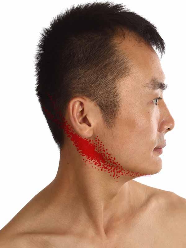 颈部肿了一块是怎么回事,颈部突然肿了一个大包