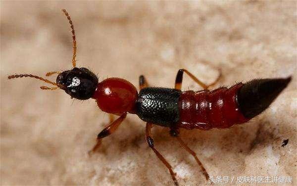 脖子带状疱疹大面积水泡,脖子起疙瘩是带状疱疹吗