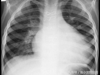 儿科高级考试总题库,儿科中级加强版题库