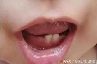 宝宝忽然不爱喝奶了,宝宝突然不爱喝奶了要吃药吗