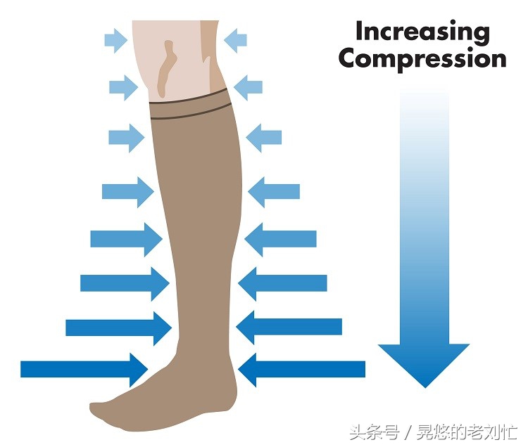 压缩袜的好处和坏处,压缩袜为什么那么紧