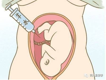 我做羊水穿刺的全过程