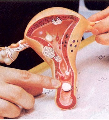 自然分娩最后分娩不出怎么办,生孩子到预产期没动静该怎么办