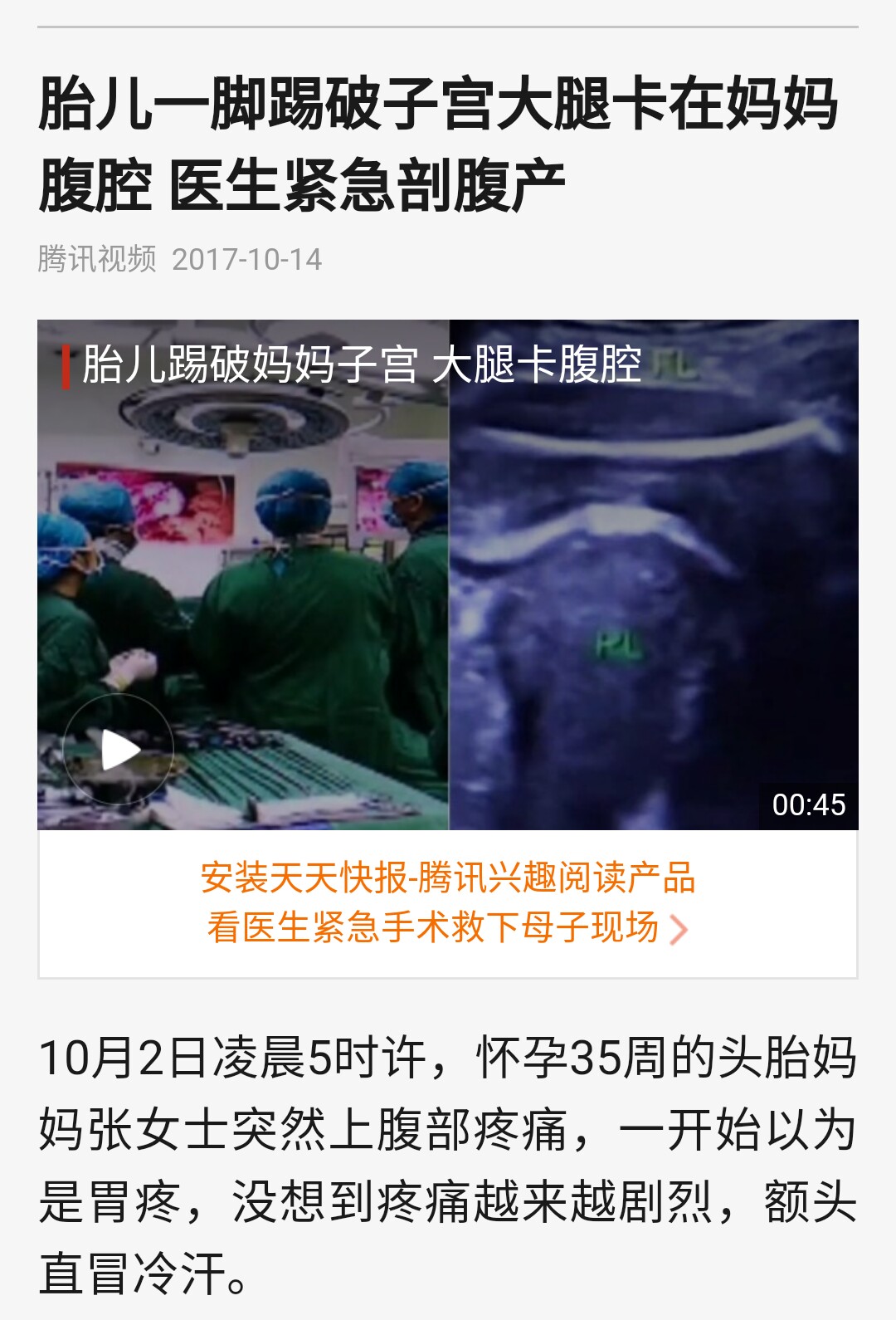 胎儿一脚踹破羊水,胎儿踢破妈妈肚子