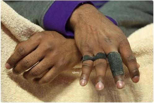 詹姆斯的脚趾头科比的手,科比的手指和脚趾