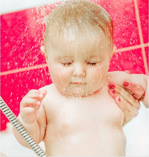 换季宝宝皮肤红红的怎么办,宝宝过敏季节皮肤怎么护理