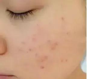 为什么它们就能成为回购率百分之百的爆款？看看功效就知道了！