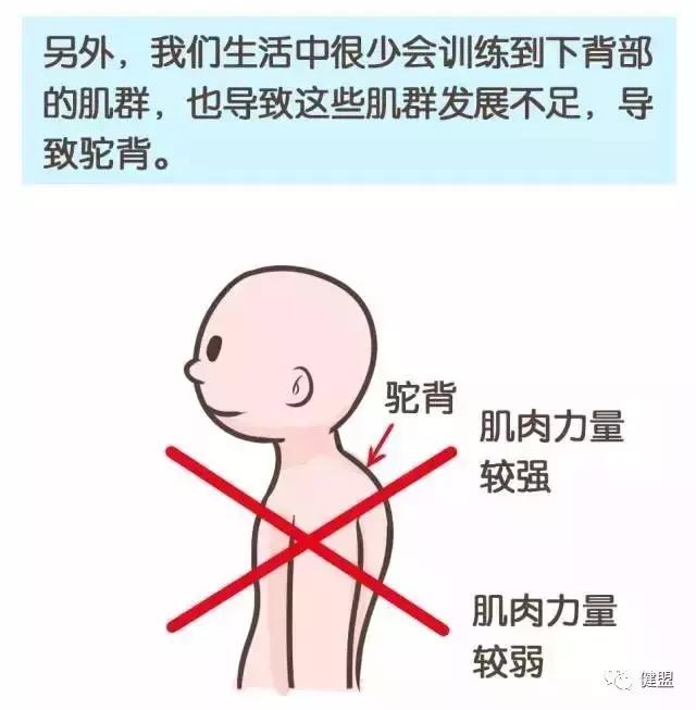 成年人驼背耸肩,一招拯救圆肩驼背