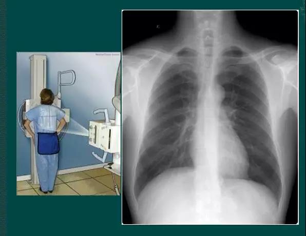 读完该文,让你学会如何看胸片