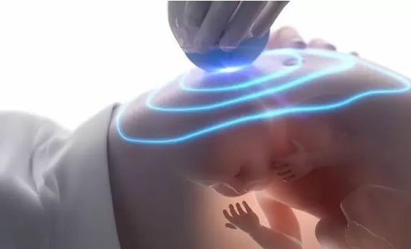 nt是唐筛吗唐筛几周做,nt和早期唐筛都过中期唐筛没过