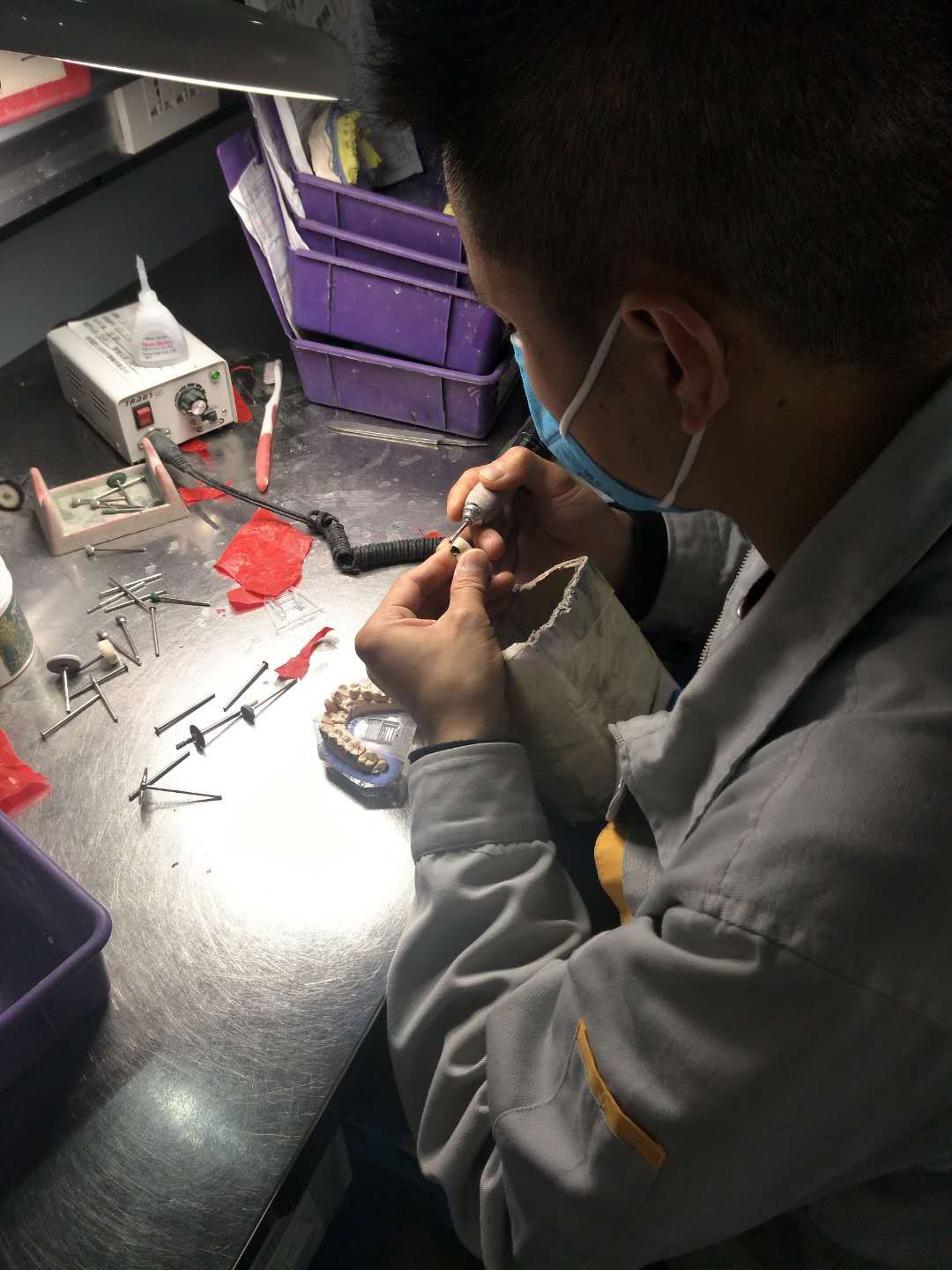 烤瓷牙连桥修复大概多少钱一颗,用烤瓷牙的方法矫正牙齿