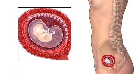 孕期先兆流产有哪些症状,孕期有先兆流产症状要注意哪些