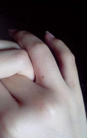 手背长痣的女人有什么特征,手背有痣的女人右手