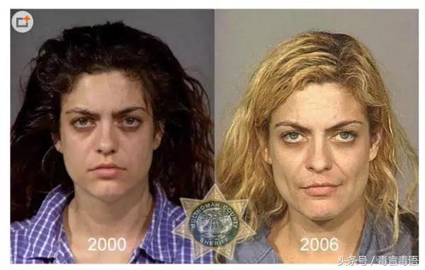 吸毒前后的变化对比,吸毒真的会毁容吗