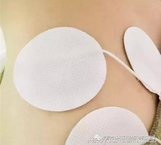 通州区妇幼保健院可以开什么药,通州妇幼37周检查项目有哪些