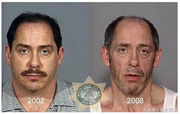 触目惊心吸毒前后真实的变化,吸毒的危害到底有多严重图片