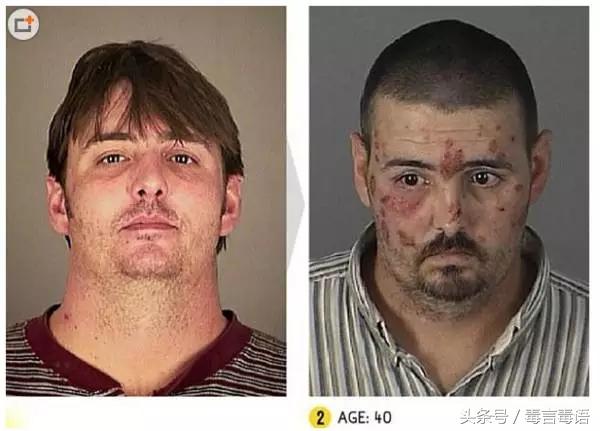 吸毒前后的变化对比,吸毒真的会毁容吗