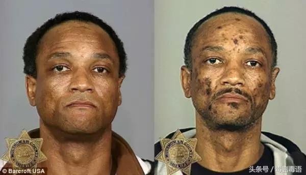 触目惊心吸毒前后真实的变化,吸毒的危害到底有多严重图片