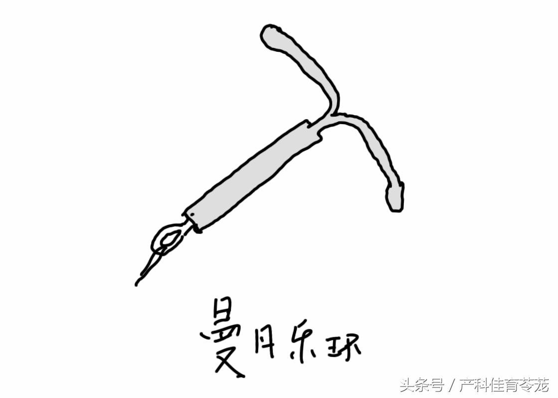 放置宫内节育器请什么假,宫内节育器放置全过程