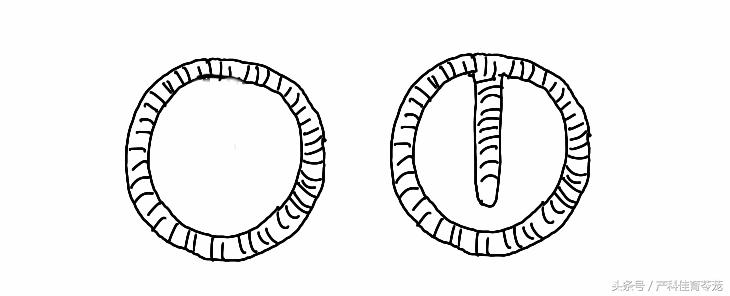 上环15天后还用避孕吗,上环前你应该详细了解这些知识