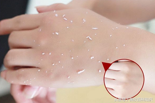 什么是角质层薄敏感皮肤,角质薄肌肤敏感怎么办