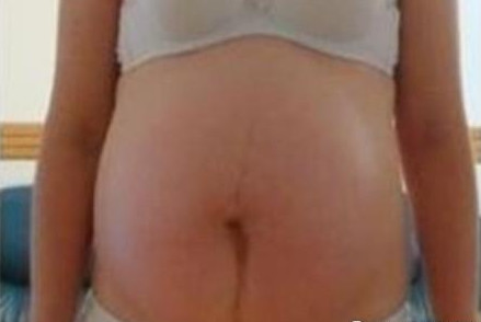 女人生孩子要经历哪些尴尬的事,女人生小孩到底有多痛苦