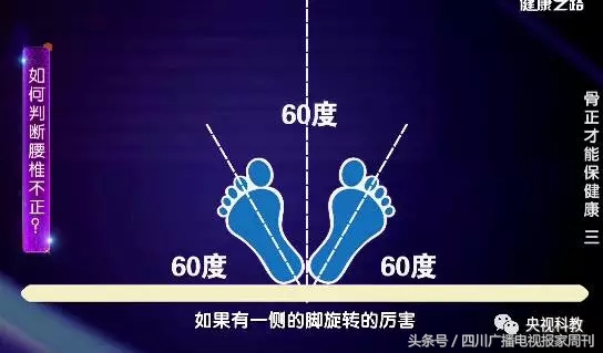 腰疼最快缓解方法不能弯腰,腰部疼痛专家来教锻炼轻松治腰痛