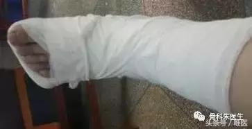 踝关节扭伤如何用药,踝关节扭伤后保守穿护踝有用吗