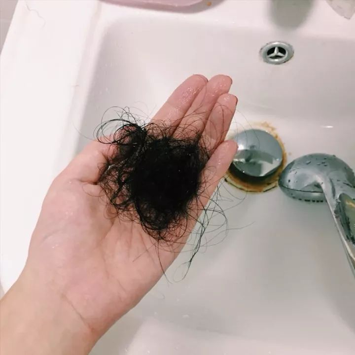 90后的叔叔阿姨，你的头发掉了