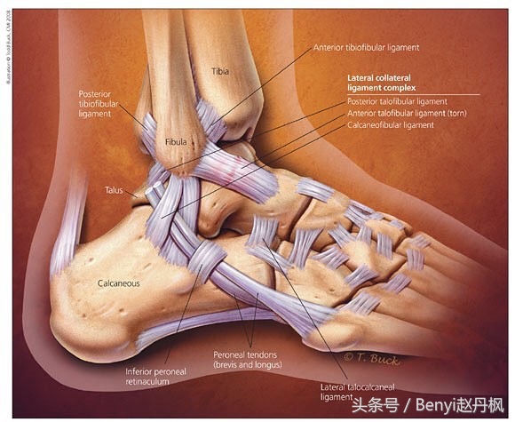 脚踝伤病的六个问题,脚踝受伤康复训练篮球