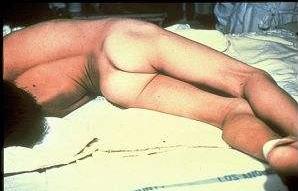 脚上长奇怪的东西是什么,脚上长了一个奇怪东西