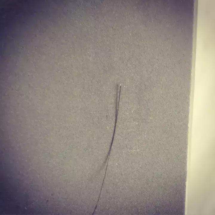 总是担心自己要秃了,怀疑自己越来越秃