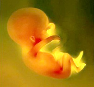 羊水栓塞的临床表现及处理,羊水栓塞临床表现有哪些