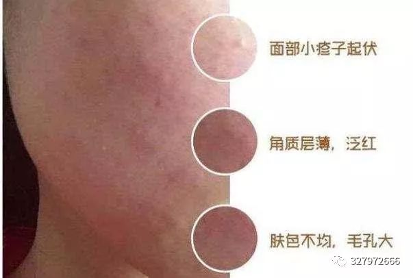 晓晓护肤科普,晓晓护肤除皱产品