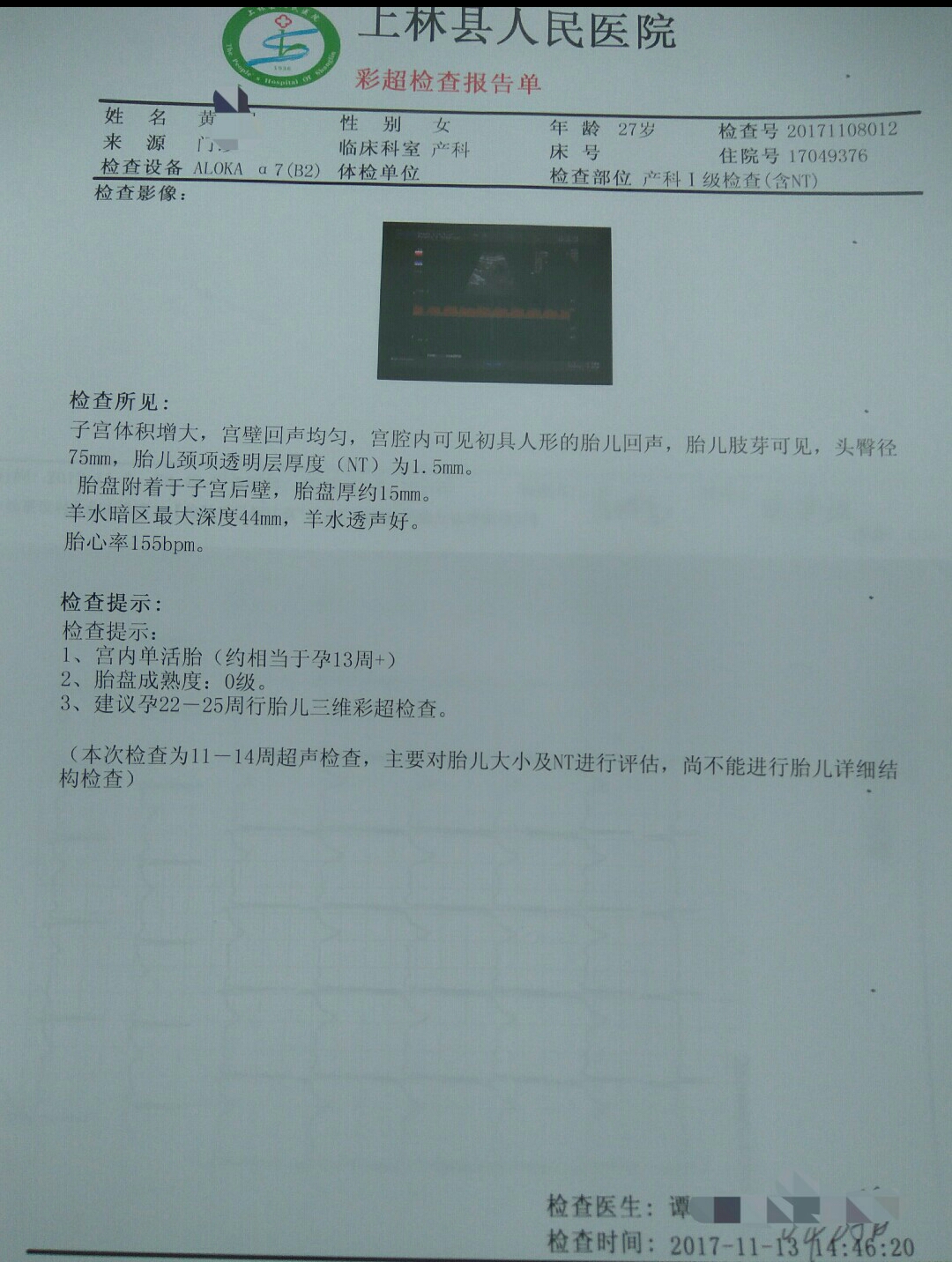 保胎过程中孕酮hcg还降了,孕酮低保胎真实感受