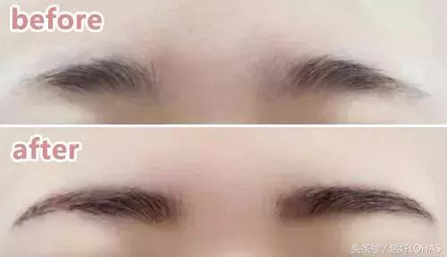 拯救发际线的生发神器,拯救发际线神器