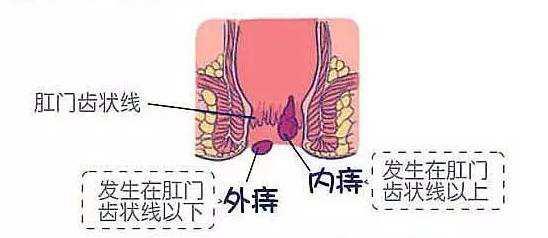 孕妇10周便秘,孕妇便秘吃什么水果排便最快最佳