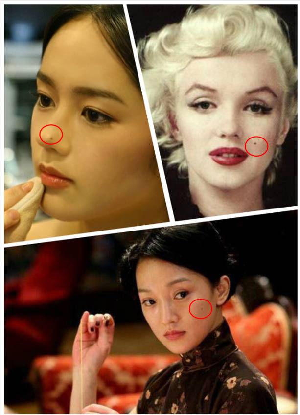 痣未结痂要擦药吗,痣没去干净会有影响吗